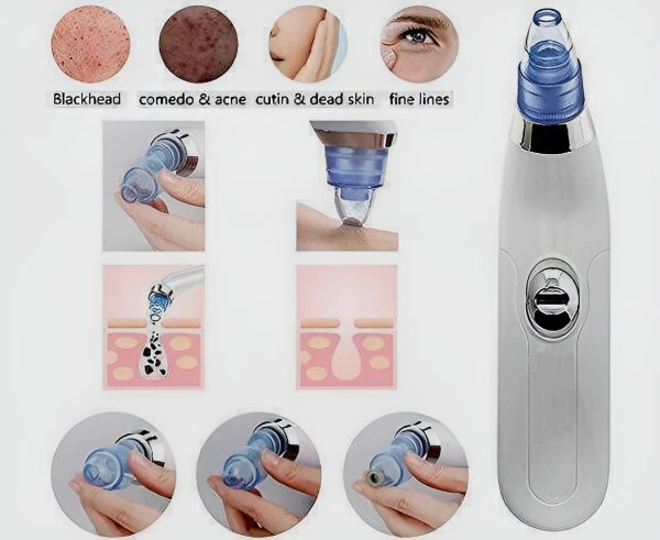 Blackheads Remover Vacuum Suction