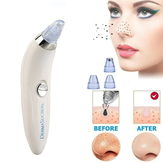 Blackheads Remover Vacuum Suction