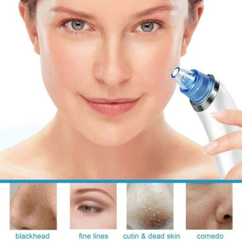 Blackheads Remover Vacuum Suction